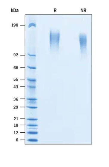 2 μg/lane Protein  was resolved with SDS-PAGE under reducing (R) and non-reducing (NR) conditions and visualized by Coomassie® Blue staining.